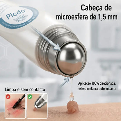🍀👑 𝐏𝒊𝐜𝐝𝒐® Removedor de Acrocórdons e Manchas em 7 Dias (Sem dor, sem cicatrizes — aplicador roll-on) 💪